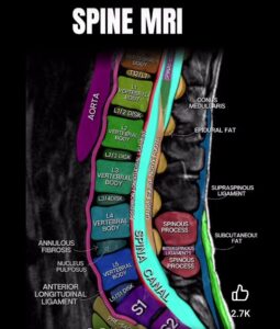 Education spinemri4
